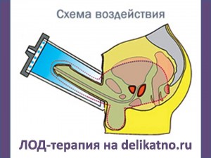���-������� ����������, ����������� ����������, ����������. infrus.ru